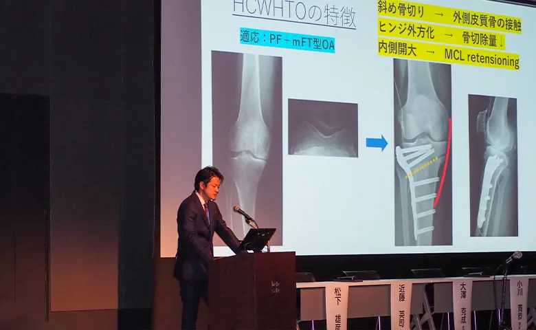 シンポジウム 横浜石心会病院 大澤克成 医師